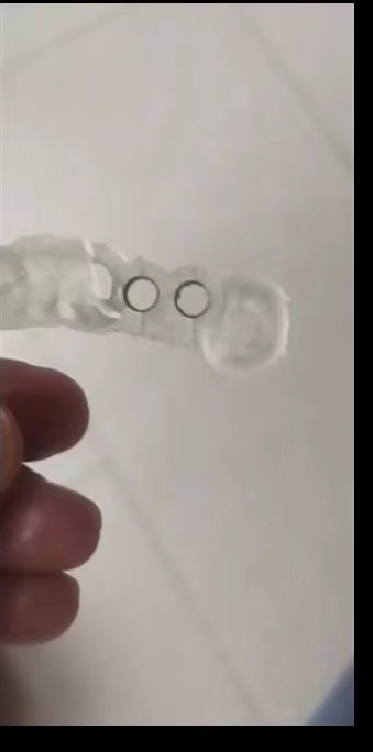 Resina dental impressora 3d gu - 3D Printing Guide avaliação e preço